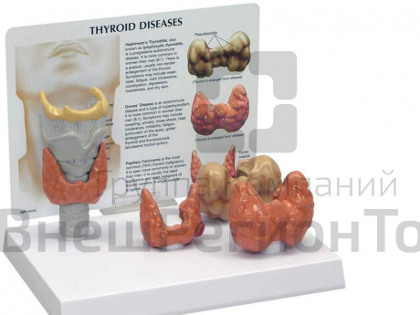 Модель щитовидной железы.
