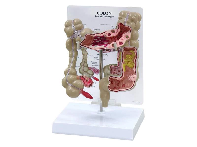 Анатомическая модель толстой кишки — 15.2×6.4×19.7 см