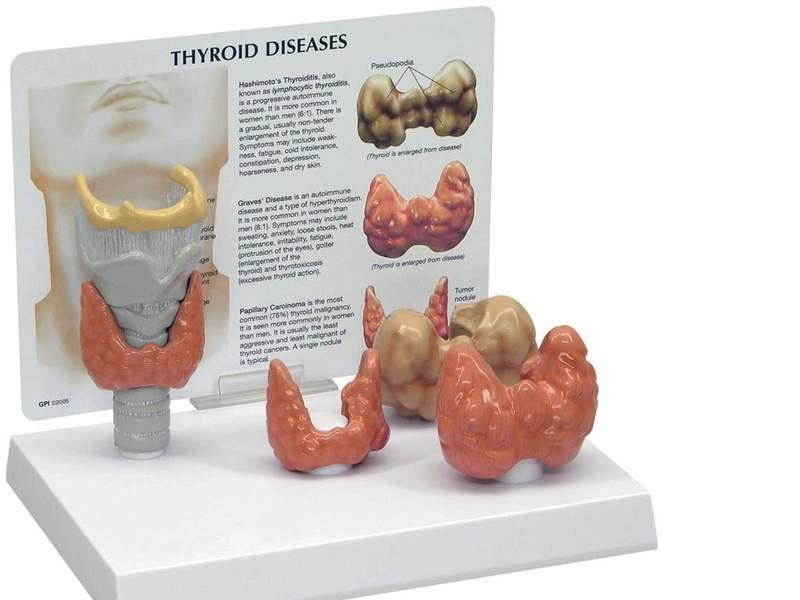 Анатомическая модель щитовидки и гортани
