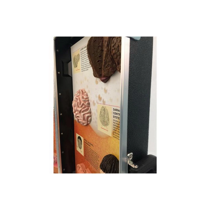 Стенд-табло «Последствия алкоголизма» в деревянном корпусе