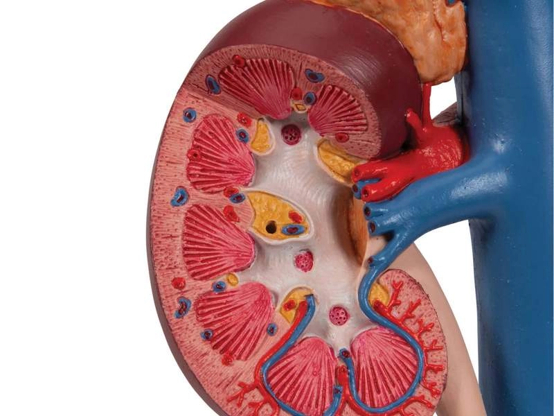 Модель почки с органами задней части верхнего отдела брюшной полости
