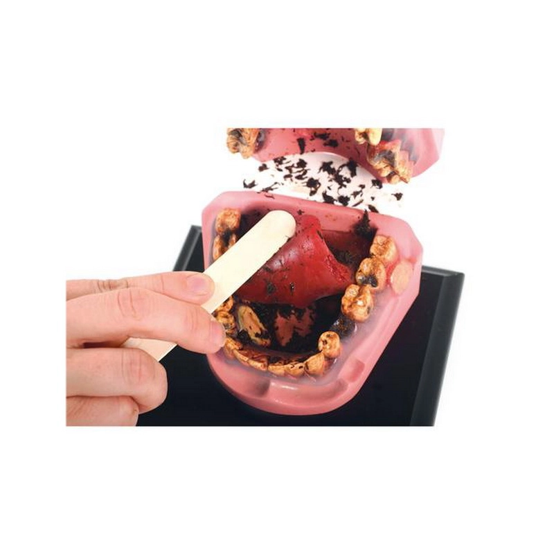 Анатомическая модель ротовой полости курильщика 15×10×20 см