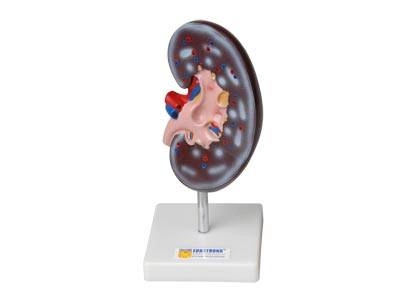 Анатомическая модель почки — сагиттальный разрез