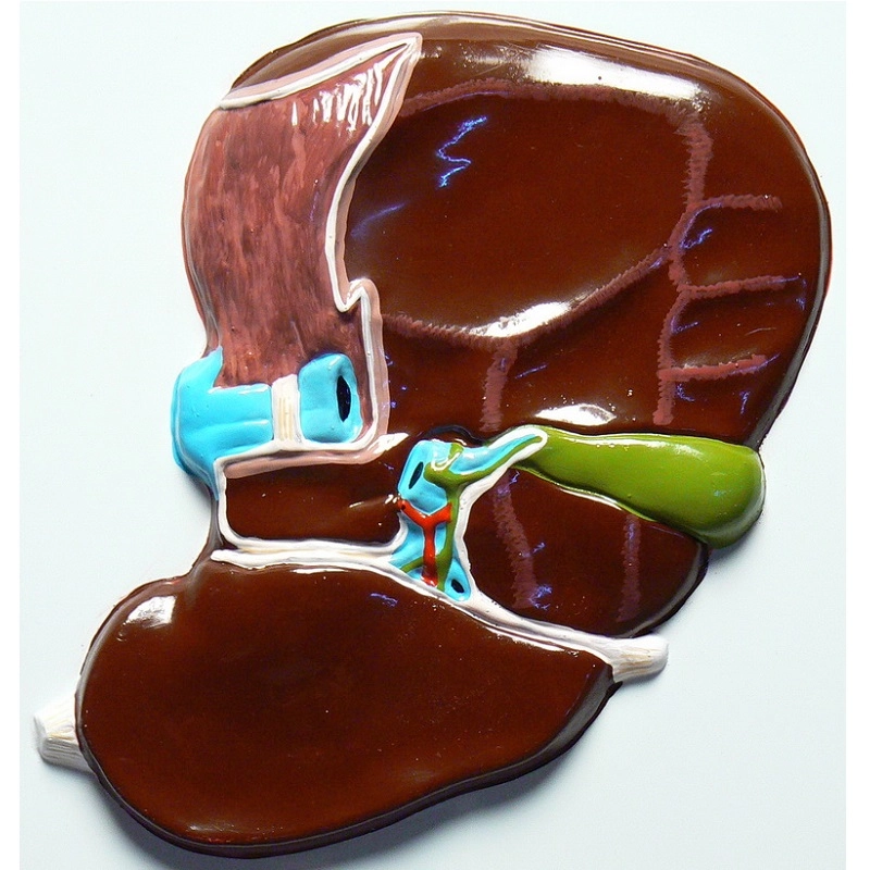 Барельефная модель печени — висцеральная поверхность