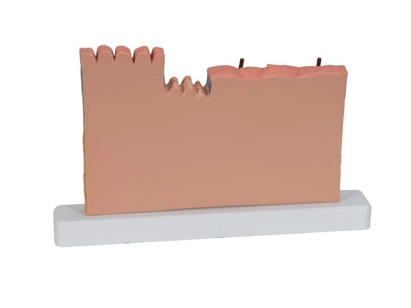 Модель сечения кожи