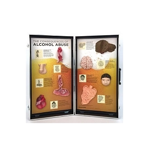 Объемный стенд Последствия алкоголизма