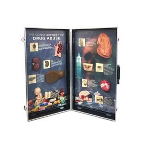 Объемный стенд Последствия злоупотребления наркотиками