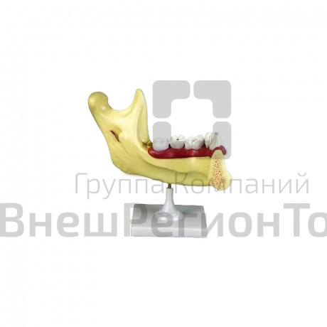 Модель "Челюсть разборная".