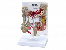 Модель толстой кишки