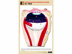 Рельефная таблица Глаз. Строение, А1