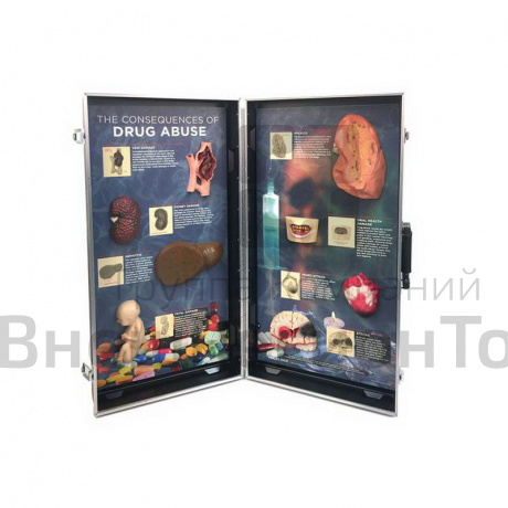 Объемный стенд Последствия злоупотребления наркотиками.