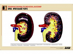 Рельефная таблица Почка. Фронтальный разрез, А1