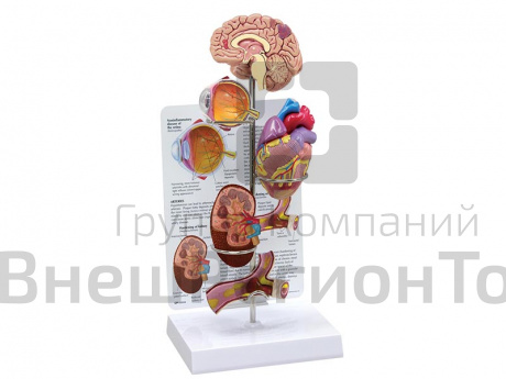 Комплект Гипертония.